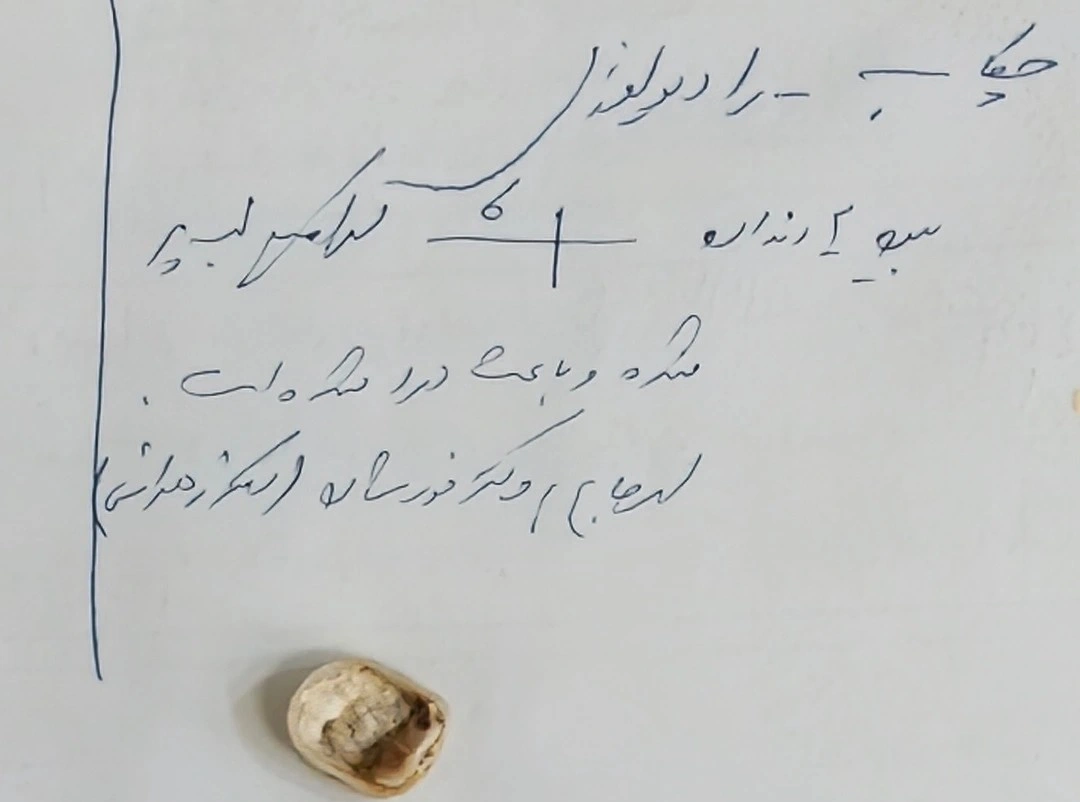 A crown that came off, showing the pattern of the cement across its intaglio surface, photographed beside the handwritten chart notes from the patient's earlier visits.