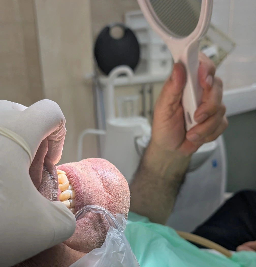 بیمار در حال نگاه‌کردن به آینه‌ی دستی حین بررسی حرکات لترالی و اکلوژن روی صندلی دندان‌پزشکی